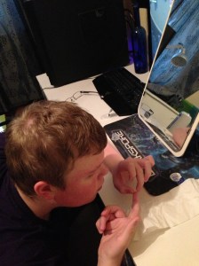 Linsinsättning Hugo 18 sept 2013 022